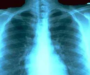 بازدید اعضای محترم بورد تخصصی فیزیک پزشکی از گروه رادیولوژی دانشکده پیراپزشکی
